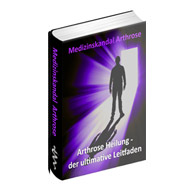Medizinskandal Arthrose - eBook
