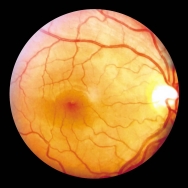 Augenrezeptur von Biotikon by Dr. Michalzik - Augenhintergrund